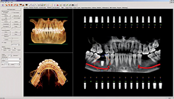 Cone Beam CT (CBCT) Certification for Dentists – University of Alberta