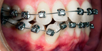 Orthodontic Module: Clinical Component