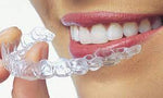 Clear Aligner Program for Dentists